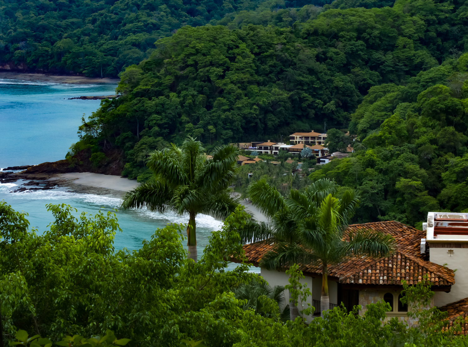 Costa Rica Dental Tourism